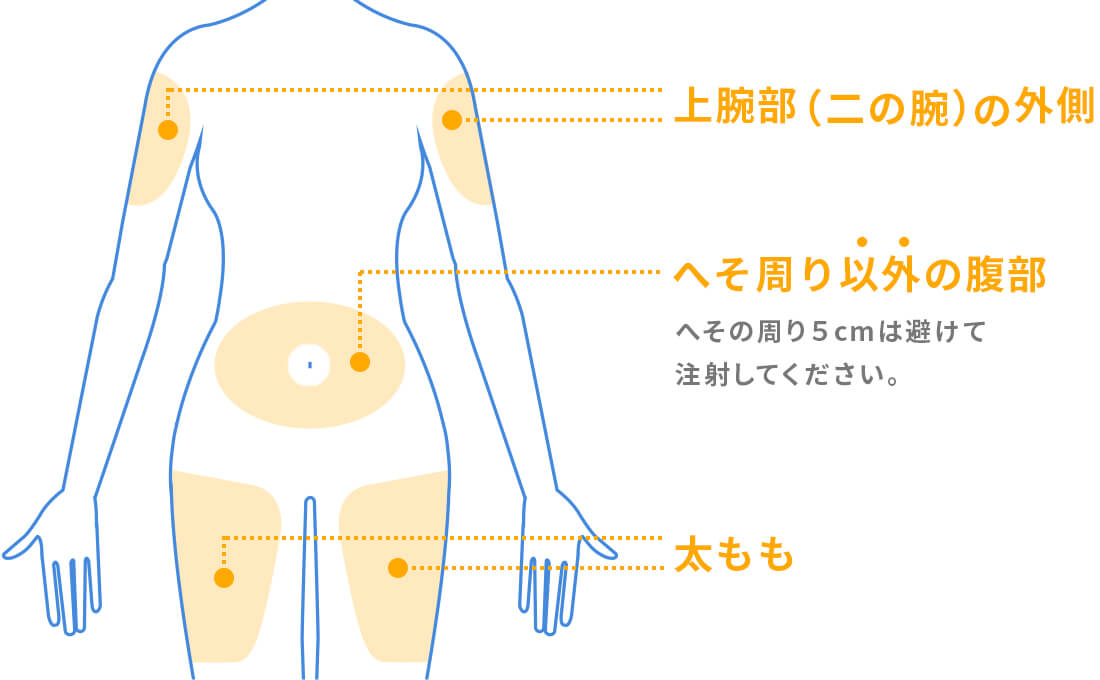 注射に適した部位